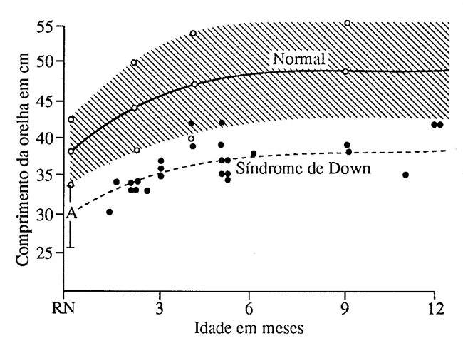 COMPRIMENTO DO PAVILHÃO AURICULAR