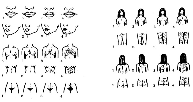 ESCORE FERRIMAN & GALLWEY