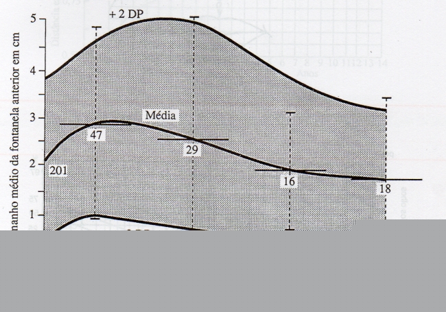 MEDIDAS DA FONTANELA ANTERIOR
